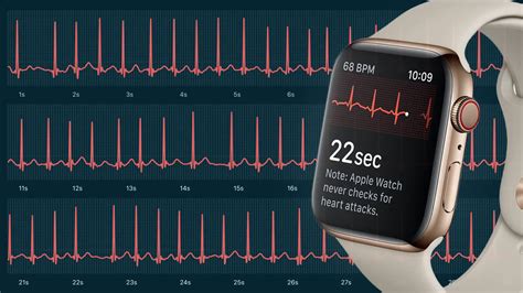 cheapest apple watch with ecg|apple watch ecg problems.